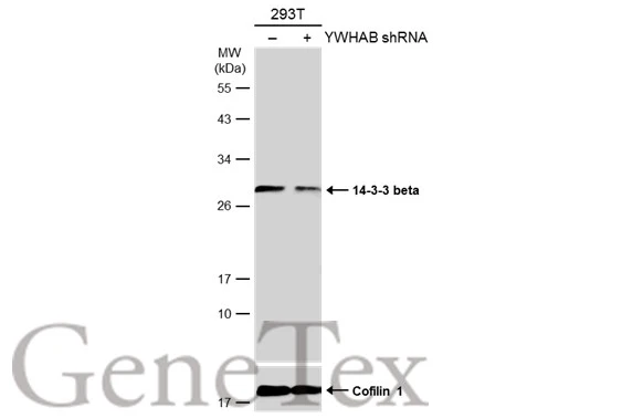Non-transfected (–) and transfected (+) 293T whole cell extracts (30 μg) were separated by 12% SDS-PAGE, and the membrane was blotted with 14-3-3 beta antibody [N1C3] (GTX113297) diluted at 1:5000. The HRP-conjugated anti-rabbit IgG antibody (GTX213110-01) was used to detect the primary antibody.