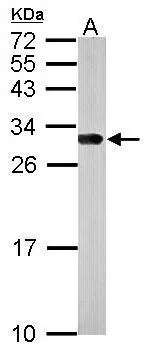 Sample (50 μg of whole cell lysate) A: mouse brain 12% SDS PAGE GTX113298 diluted at 1:10000 The HRP-conjugated anti-rabbit IgG antibody (GTX213110-01) was used to detect the primary antibody.
