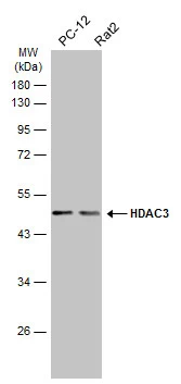 Various whole cell extracts (30 μg) were separated by 10% SDS-PAGE, and the membrane was blotted with HDAC3 antibody (GTX113303) diluted at 1:1000. The HRP-conjugated anti-rabbit IgG antibody (GTX213110-01) was used to detect the primary antibody. Various whole cell extracts (30 μg) were separated by 10% SDS-PAGE, and the membrane was blotted with HDAC3 antibody (GTX113303) diluted at 1:1000. The HRP-conjugated anti-rabbit IgG antibody (GTX213110-01) was used to detect the primary antibody.