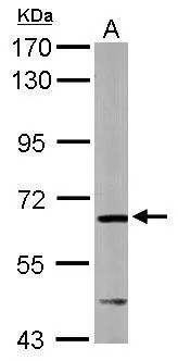 Sample (50 ug of whole cell lysate) A: mouse liver 7.5% SDS PAGE GTX113306 diluted at 1:1000 Sample (50 ug of whole cell lysate) A: mouse liver 7.5% SDS PAGE GTX113306 diluted at 1:1000