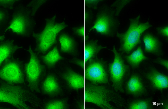AKT3 antibody detects AKT3 protein at cytoplasm by immunofluorescent analysis. Sample: HeLa cells were fixed in 4% paraformaldehyde at RT for 15 min. Green: AKT3 stained by AKT3 antibody (GTX113312) diluted at 1:500. Blue: Hoechst 33342 staining. Scale bar= 10 μm.