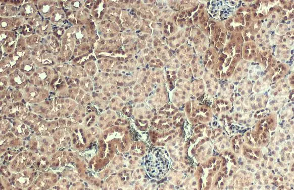AKT3 antibody detects AKT3 protein at nucleus by immunohistochemical analysis. Sample: Paraffin-embedded mouse kidney. AKT3 stained by AKT3 antibody (GTX113312) diluted at 1:500. Antigen Retrieval: Citrate buffer, pH 6.0, 15 min