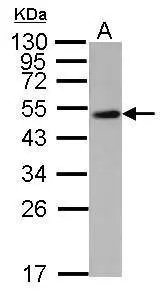 Sample (50 μg of whole cell lysate) A: mouse brain 12% SDS PAGE GTX113325 diluted at 1:10000 The HRP-conjugated anti-rabbit IgG antibody (GTX213110-01) was used to detect the primary antibody.
