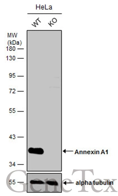 Wild-type (WT) and Annexin A1 knockout (KO) HeLa cell extracts (30 μg) were separated by 10% SDS-PAGE, and the membrane was blotted with Annexin A1 antibody (GTX113329) diluted at 1:3000. The HRP-conjugated anti-rabbit IgG antibody (GTX213110-01) was used to detect the primary antibody. Wild-type (WT) and Annexin A1 knockout (KO) HeLa cell extracts (30 μg) were separated by 10% SDS-PAGE, and the membrane was blotted with Annexin A1 antibody (GTX113329) diluted at 1:3000. The HRP-conjugated anti-rabbit IgG antibody (GTX213110-01) was used to detect the primary antibody.