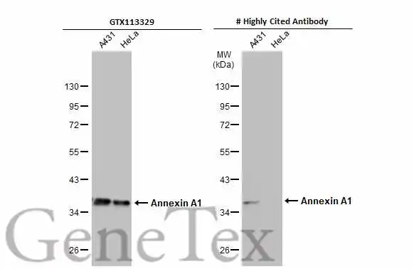 Various whole cell extracts (30 μg) were separated by 10% SDS-PAGE, and the membranes were blotted with Annexin A1 antibody (GTX113329) diluted at 1:5000 and competitor's antibody diluted at 1:5000. The HRP-conjugated anti-rabbit IgG antibody (GTX213110-01) was used to detect the primary antibody. *The competitor is not affiliated with GeneTex and does not endorse this product. Various whole cell extracts (30 μg) were separated by 10% SDS-PAGE, and the membranes were blotted with Annexin A1 antibody (GTX113329) diluted at 1:5000 and competitor's antibody diluted at 1:5000. The HRP-conjugated anti-rabbit IgG antibody (GTX213110-01) was used to detect the primary antibody. *The competitor is not affiliated with GeneTex and does not endorse this product.