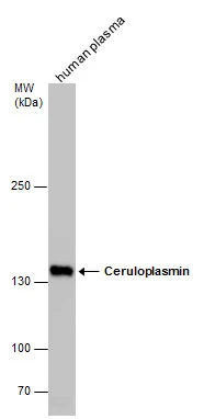 Ceruloplasmin antibody [C2C3], C-term detects Ceruloplasmin [C2C3], C-term protein by western blot analysis. Human tissue extracts (30 μg) was separated by 5% SDS-PAGE, and the membrane was blotted with Ceruloplasmin antibody [C2C3], C-term (GTX113333) diluted at 1:1000.