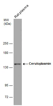 Rat tissue extract (50 μg) was separated by 5% SDS-PAGE, and the membrane was blotted with Ceruloplasmin antibody (GTX113333) diluted at 1:500.