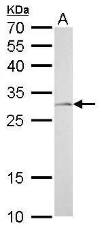 NQO1 antibody