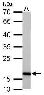 Stathmin 1 antibody detects STMN1 protein by Western blot analysis. A. 50 μg mouse brain lysate/extract 12 % SDS-PAGE Stathmin 1 antibody (GTX113341) dilution: 1:500