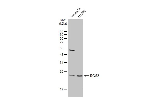 Various whole cell extracts (30 μg) were separated by 12% SDS-PAGE, and the membrane was blotted with RGS2 antibody [N1C3-3] (GTX113349) diluted at 1:1000. The HRP-conjugated anti-rabbit IgG antibody (GTX213110-01) was used to detect the primary antibody.