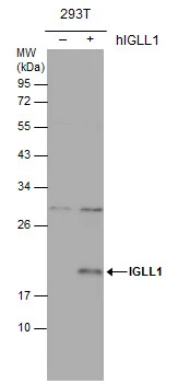 Non-transfected (–) and transfected (+) 293T whole cell extracts (30 μg) were separated by 12% SDS-PAGE, and the membrane was blotted with IGLL1 antibody (GTX113366) diluted at 1:1000.