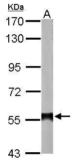 Sample (20 ug of whole cell lysate) A: mouse brain 7.5% SDS PAGE GTX113379 diluted at 1:10000 Sample (20 ug of whole cell lysate) A: mouse brain 7.5% SDS PAGE GTX113379 diluted at 1:10000