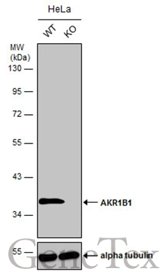 Wild-type (WT) and AKR1B1 knockout (KO) HeLa cell extracts (30 μg) were separated by 10% SDS-PAGE, and the membrane was blotted with AKR1B1 antibody [N1C3] (GTX113381) diluted at 1:2500. The HRP-conjugated anti-rabbit IgG antibody (GTX213110-01) was used to detect the primary antibody.