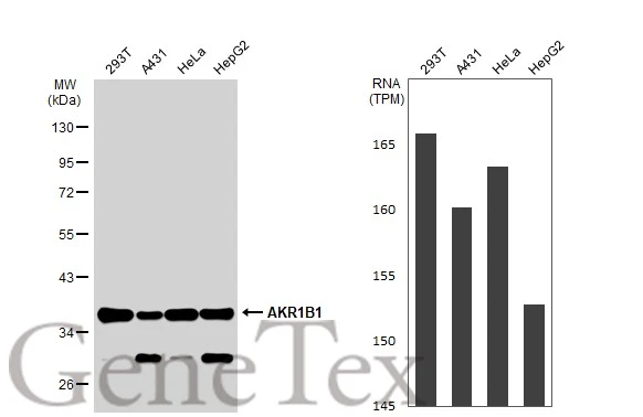 Various whole cell extracts (30 μg) were separated by 10% SDS-PAGE, and the membrane was blotted with AKR1B1 antibody [N1C3] (GTX113381) diluted at 1:1000. The HRP-conjugated anti-rabbit IgG antibody (GTX213110-01) was used to detect the primary antibody. Corresponding RNA expression data for the same cell lines are based on Human Protein Atlas program.