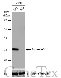 Wild-type (WT) and Annexin V knockout (KO) 293T cell extracts (30 μg) were separated by 10% SDS-PAGE, and the membrane was blotted with Annexin V antibody [N2C3] (GTX113384) diluted at 1:5000. The HRP-conjugated anti-rabbit IgG antibody (GTX213110-01) was used to detect the primary antibody.