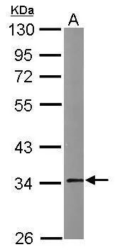 Sample (50 ug of whole cell lysate) A: Mouse brain 10% SDS PAGE GTX113384 diluted at 1:1000 Sample (50 ug of whole cell lysate) A: Mouse brain 10% SDS PAGE GTX113384 diluted at 1:1000
