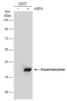 Anti-Aspartoacylase antibody [N1C3-2] (GTX113389) | GeneTex