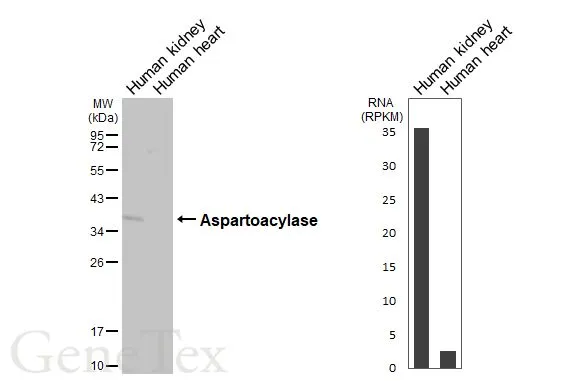 Anti-Aspartoacylase antibody [N1C3-2] (GTX113389) | GeneTex