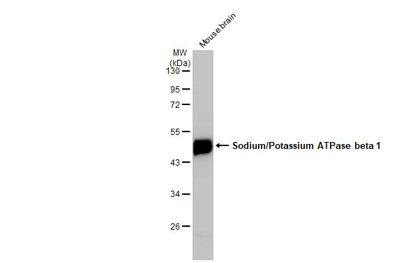 Mouse tissue extract (50 μg) was separated by 10% SDS-PAGE, and the membrane was blotted with Sodium/Potassium ATPase beta 1 antibody (GTX113390) diluted at 1:1000. The HRP-conjugated anti-rabbit IgG antibody (GTX213110-01) was used to detect the primary antibody.