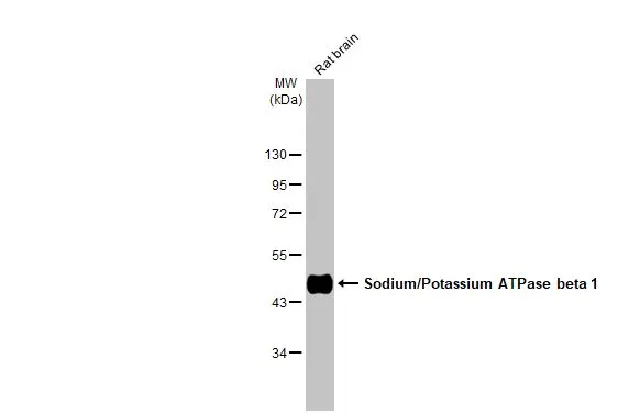 Rat tissue extract (50 μg) was separated by 10% SDS-PAGE, and the membrane was blotted with Sodium/Potassium ATPase beta 1 antibody (GTX113390) diluted at 1:1000. The HRP-conjugated anti-rabbit IgG antibody (GTX213110-01) was used to detect the primary antibody.