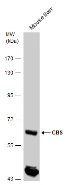CBS antibody detects CBS protein by western blot analysis. Mouse tissue extracts (50 μg) was separated by 7.5% SDS-PAGE, and the membrane was blotted with CBS antibody (GTX113400) diluted by 1:5000. The HRP-conjugated anti-rabbit IgG antibody (GTX213110-01) was used to detect the primary antibody.
