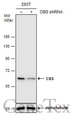 Non-transfected (–) and transfected (+) 293T whole cell extracts (30 μg) were separated by 7.5% SDS-PAGE, and the membrane was blotted with CBS antibody (GTX113400) diluted at 1:3000. The HRP-conjugated anti-rabbit IgG antibody (GTX213110-01) was used to detect the primary antibody.