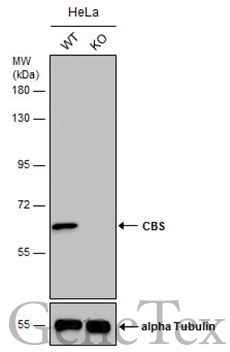 CBS antibody