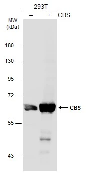 Non-transfected (–) and transfected (+) 293T whole cell extracts (30 μg) were separated by 7.5% SDS-PAGE, and the membrane was blotted with CBS antibody (GTX113400) diluted at 1:1000. The HRP-conjugated anti-rabbit IgG antibody (GTX213110-01) was used to detect the primary antibody.