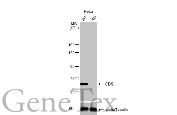 Wild-type (WT) and CBS knockout (KO) HeLa cell extracts (30 μg) were separated by 7.5% SDS-PAGE, and the membrane was blotted with CBS antibody (GTX113400) diluted at 1:2000. The HRP-conjugated anti-rabbit IgG antibody (GTX213110-01) was used to detect the primary antibody.