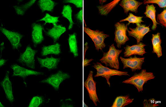 CBS antibody detects CBS protein at cytoplasm and nucleus by immunofluorescent analysis. Sample: HeLa cells were fixed in ice-cold MeOH for 5 min. Green: CBS stained by CBS antibody (GTX113400) diluted at 1:500. Red: alpha Tubulin, a cytoskeleton marker, stained by alpha Tubulin antibody [GT114] (GTX628802) diluted at 1:1000. Blue: Fluoroshield with DAPI (GTX30920). Scale bar= 10μm.