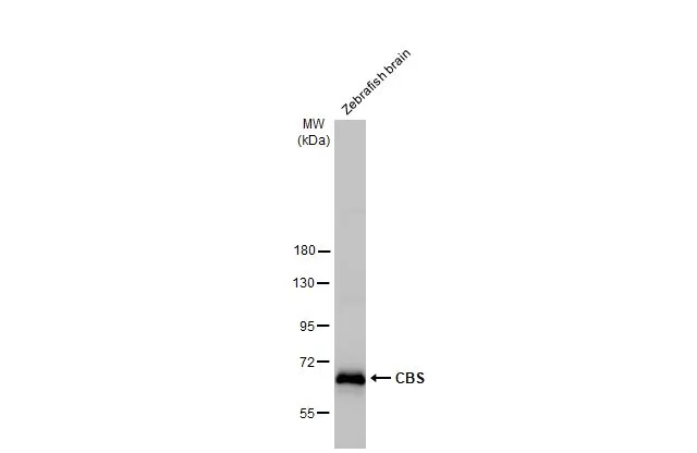 Zebrafish tissue extract (30 μg) was separated by 7.5% SDS-PAGE, and the membrane was blotted with CBS antibody (GTX113400) diluted at 1:1000. The HRP-conjugated anti-rabbit IgG antibody (GTX213110-01) was used to detect the primary antibody.