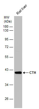 Rat tissue extract (50 μg) was separated by 10% SDS-PAGE, and the membrane was blotted with CTH antibody (GTX113409) diluted at 1:3000. The HRP-conjugated anti-rabbit IgG antibody (GTX213110-01) was used to detect the primary antibody. Rat tissue extract (50 μg) was separated by 10% SDS-PAGE, and the membrane was blotted with CTH antibody (GTX113409) diluted at 1:3000. The HRP-conjugated anti-rabbit IgG antibody (GTX213110-01) was used to detect the primary antibody.