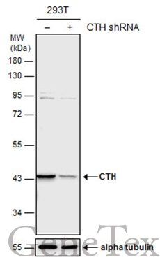 Non-transfected (–) and transfected (+) 293T whole cell extracts (30 μg) were separated by 10% SDS-PAGE, and the membrane was blotted with CTH antibody (GTX113409) diluted at 1:4000. The HRP-conjugated anti-rabbit IgG antibody (GTX213110-01) was used to detect the primary antibody. Non-transfected (–) and transfected (+) 293T whole cell extracts (30 μg) were separated by 10% SDS-PAGE, and the membrane was blotted with CTH antibody (GTX113409) diluted at 1:4000. The HRP-conjugated anti-rabbit IgG antibody (GTX213110-01) was used to detect the primary antibody.