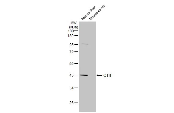 Various tissue extracts (50 μg) were separated by 10% SDS-PAGE, and the membrane was blotted with CTH antibody (GTX113409) diluted at 1:1000. The HRP-conjugated anti-rabbit IgG antibody (GTX213110-01) was used to detect the primary antibody. Various tissue extracts (50 μg) were separated by 10% SDS-PAGE, and the membrane was blotted with CTH antibody (GTX113409) diluted at 1:1000. The HRP-conjugated anti-rabbit IgG antibody (GTX213110-01) was used to detect the primary antibody.