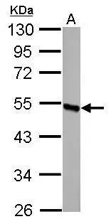 DBT antibody