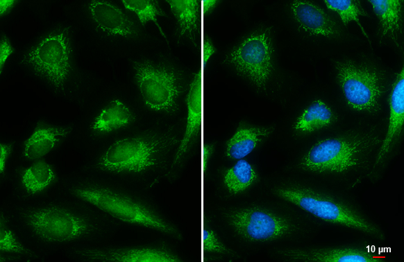 DBT antibody detects DBT protein at mitochondria by immunofluorescent analysis. Sample: HeLa cells were fixed in 4% paraformaldehyde at RT for 15 min. Green: DBT stained by DBT antibody (GTX113412) diluted at 1:500. Blue: Hoechst 33342 staining. Scale bar= 10 μm.