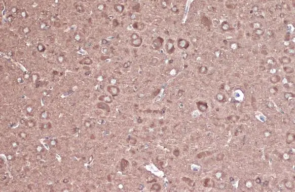 CRMP2 antibody [N1N3] detects CRMP2 protein at cytoplasm by immunohistochemical analysis. Sample: Paraffin-embedded rat brain. CRMP2 stained by CRMP2 antibody [N1N3] (GTX113420) diluted at 1:500. Antigen Retrieval: Citrate buffer, pH 6.0, 15 min