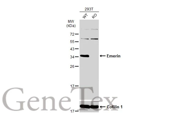 Wild-type (WT) and Emerin knockout (KO) 293T cell extracts (30 μg) were separated by 12% SDS-PAGE, and the membrane was blotted with Emerin antibody (GTX113427) diluted at 1:5000. The HRP-conjugated anti-rabbit IgG antibody (GTX213110-01) was used to detect the primary antibody. Wild-type (WT) and Emerin knockout (KO) 293T cell extracts (30 μg) were separated by 12% SDS-PAGE, and the membrane was blotted with Emerin antibody (GTX113427) diluted at 1:5000. The HRP-conjugated anti-rabbit IgG antibody (GTX213110-01) was used to detect the primary antibody.