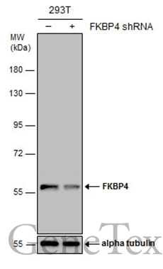 Non-transfected (–) and transfected (+) 293T whole cell extracts (30 μg) were separated by 7.5% SDS-PAGE, and the membrane was blotted with FKBP4 antibody (GTX113437) diluted at 1:3000.