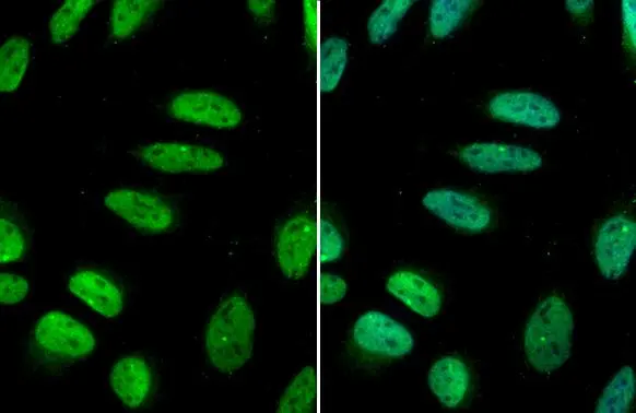 GATA2 antibody detects GATA2 protein at nucleus by immunofluorescent analysis. Sample: HeLa cells were fixed in 4% paraformaldehyde at RT for 15 min. Green: GATA2 stained by GATA2 antibody (GTX113441) diluted at 1:500. Blue: Fluoroshield with DAPI (GTX30920).