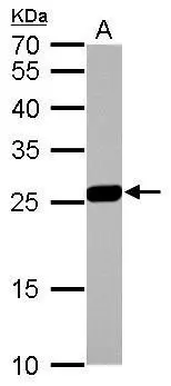 GSTM1 antibody detects GSTM1 protein by western blot analysis. A. 50 μg rat liver lysate/extract 12% SDS-PAGE GSTM1 antibody (GTX113448) dilution: 1:2000 The HRP-conjugated anti-rabbit IgG antibody (GTX213110-01) was used to detect the primary antibody.