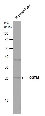 Human tissue extract (30 μg) was separated by 12% SDS-PAGE, and the membrane was blotted with GSTM1 antibody (GTX113448) diluted at 1:1000. The HRP-conjugated anti-rabbit IgG antibody (GTX213110-01) was used to detect the primary antibody.
