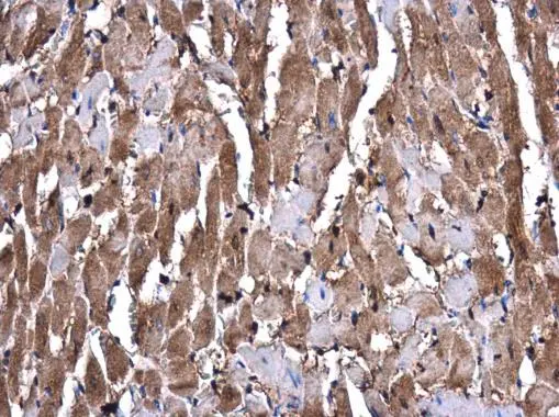 GSTM1 antibody detects GSTM1 protein at cytoplasm in rat heart by immunohistochemical analysis. Sample: Paraffin-embedded rat heart. GSTM1 antibody (GTX113448) diluted at 1:400. 
 Antigen Retrieval: Citrate buffer, pH 6.0, 15 min
