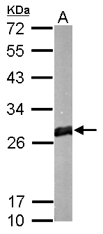 GSTM1 antibody detects protein by western blot analysis. A. 50 μg mouse brain lysate/extract 12% SDS-PAGE GSTM1 antibody (GTX113448) dilution: 1:1000 The HRP-conjugated anti-rabbit IgG antibody (GTX213110-01) was used to detect the primary antibody.