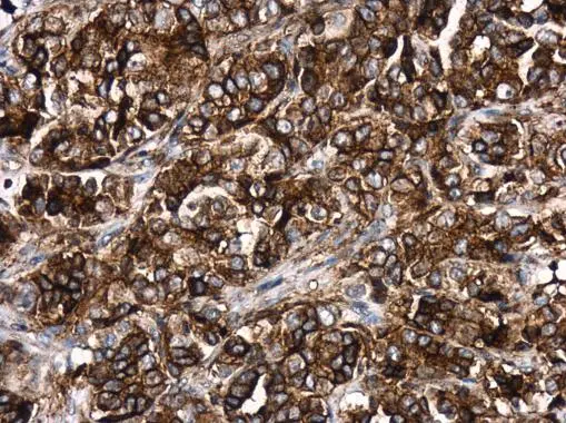 HLA-DR antibody [N2C3]
