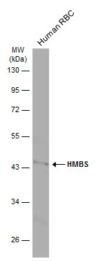 Human RBC (30 μg) was separated by 10% SDS-PAGE, and the membrane was blotted with HMBS antibody [N2C3] (GTX113460) diluted at 1:500. The HRP-conjugated anti-rabbit IgG antibody (GTX213110-01) was used to detect the primary antibody, and the signal was developed with Trident ECL plus-Enhanced.