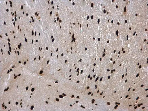hnRNP C1/C2 antibody detects hnRNP C1/C2 protein at nucleus in mouse brain by immunohistochemical analysis. Sample: Paraffin-embedded mouse brain. hnRNP C1/C2 antibody (GTX113463) diluted at 1:500. 
 Antigen Retrieval: Citrate buffer, pH 6.0, 15 min