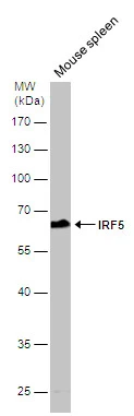 IRF5 antibody [N1C1]