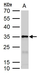 Galectin3 antibody detects Galectin3 protein by western blot analysis. A. 50 μg rat colon lysate/extract 12 % SDS-PAGE Galectin3 antibody (GTX113486) dilution: 1:10000 Galectin3 antibody detects Galectin3 protein by western blot analysis. A. 50 μg rat colon lysate/extract 12 % SDS-PAGE Galectin3 antibody (GTX113486) dilution: 1:10000