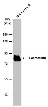 Human milk (5 μg) was separated by 7.5% SDS-PAGE, and the membrane was blotted with Lactoferrin antibody (GTX113488) diluted at 1:20000. The HRP-conjugated anti-rabbit IgG antibody (GTX213110-01) was used to detect the primary antibody. Human milk (5 μg) was separated by 7.5% SDS-PAGE, and the membrane was blotted with Lactoferrin antibody (GTX113488) diluted at 1:20000. The HRP-conjugated anti-rabbit IgG antibody (GTX213110-01) was used to detect the primary antibody.